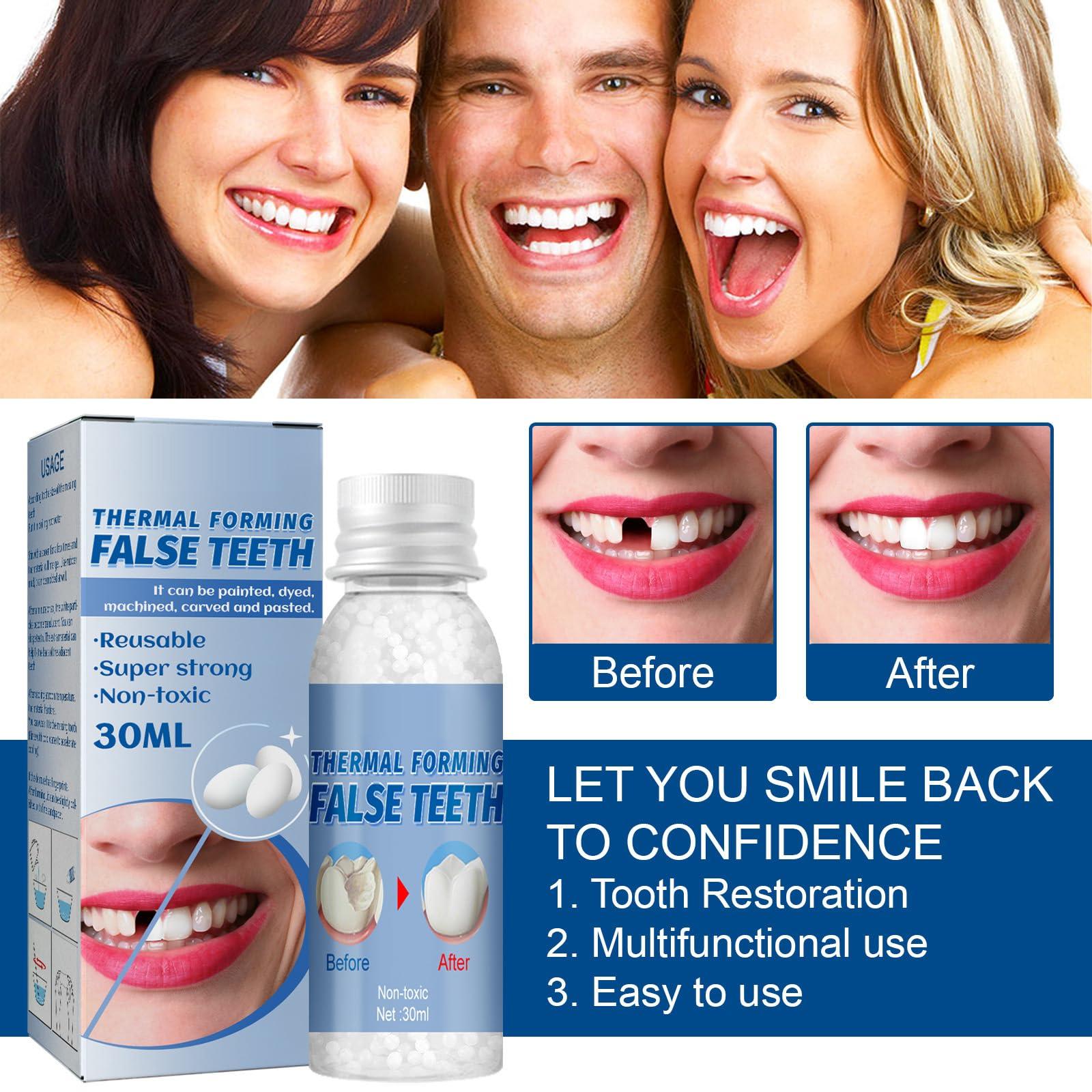 Temporary Teeth Repair Kit